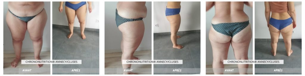 stpehanie_resultats_chrononutrition